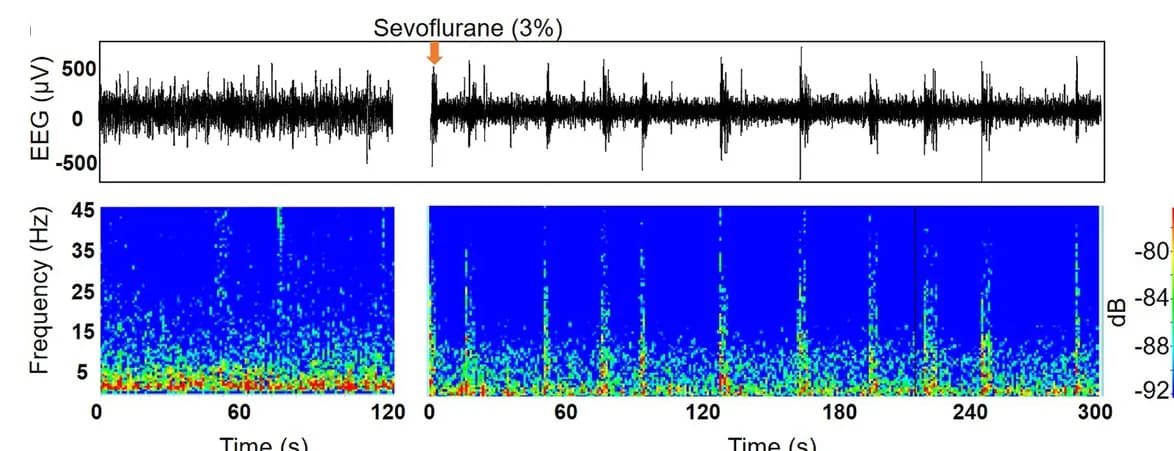 Open access visualization of Heatmap, Line Plot, EEG, Raw Traces, Power Spectrograms