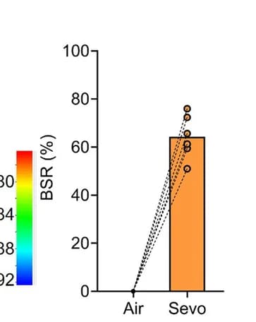 Open access visualization of Bar Plot, Prolonged Anesthesia, Burst Suppression, Hippocampus, Burst Suppression Ratio