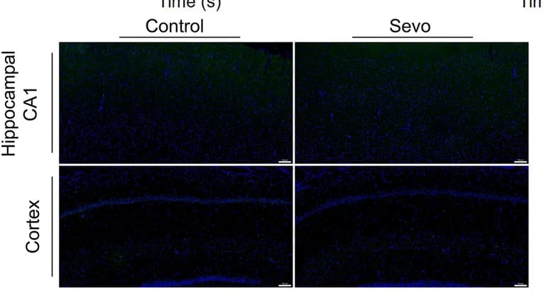 Open access visualization of Microscopy, TUNEL Staining, Brain Slices, Prolonged Anesthesia
