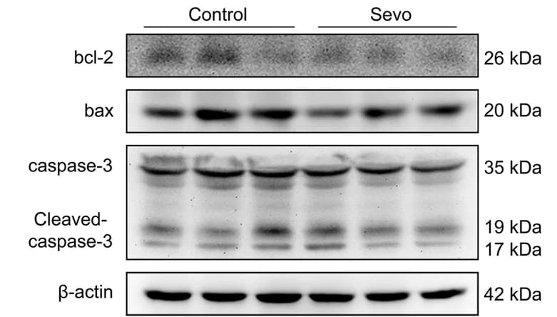 Open access visualization of Gel, Prolonged Anesthesia, Apoptotic Pathways
