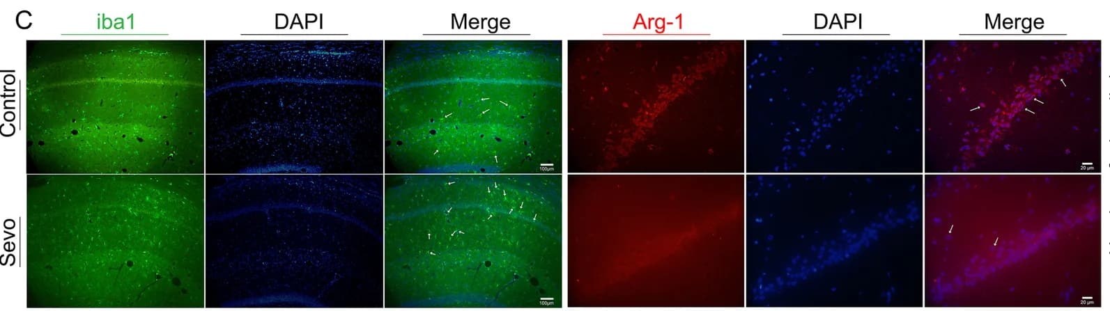 Open access visualization of Microscopy, Arg1, Hippocampus