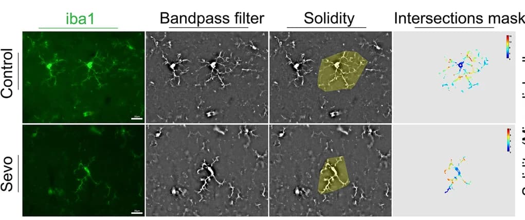 Open access visualization of Microscopy, Microglia, Microglial Morphology, ImageJ, IF Staining