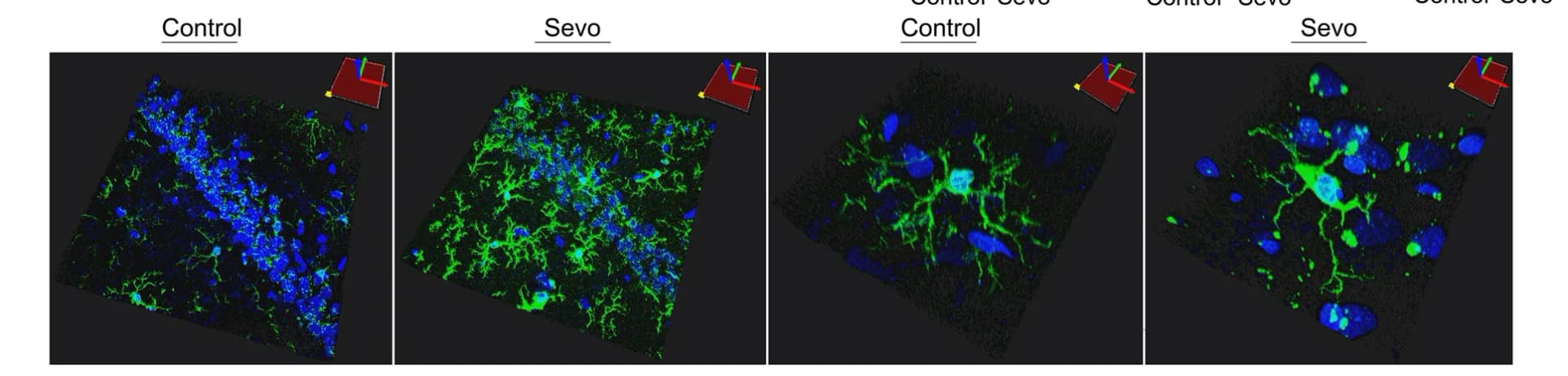 Open access visualization of Microscopy, Microglia, 3-Dimensional Image Reconstruction, Cell Body, Pseudopodia