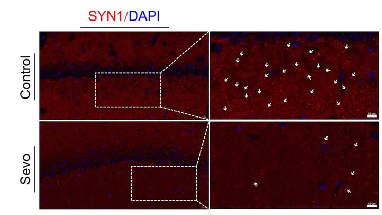 Open access visualization of Microscopy, Synaptic Density, Hippocampal CA1 Region, Anesthesia, Synapse
