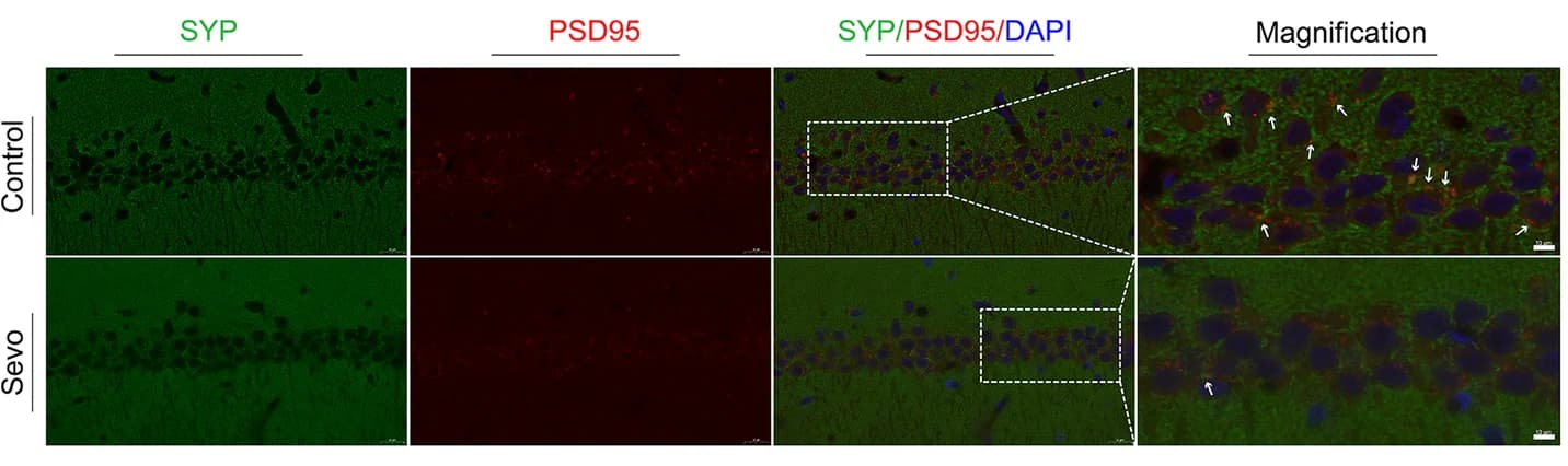 Open access visualization of Microscopy, Anesthesia, Synapse, Presynaptic Protein, Postsynaptic Protein