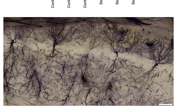 Open access visualization of Microscopy, Golgi Staining, Hippocampal CA1 Region