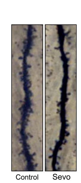 Open access visualization of Microscopy, Anesthesia, Dendritic Spines, Dendrite