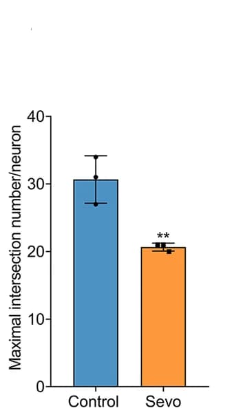 Open access visualization of Bar Plot, Error Bars, Neuron, Dendrite, Dendritic Spines