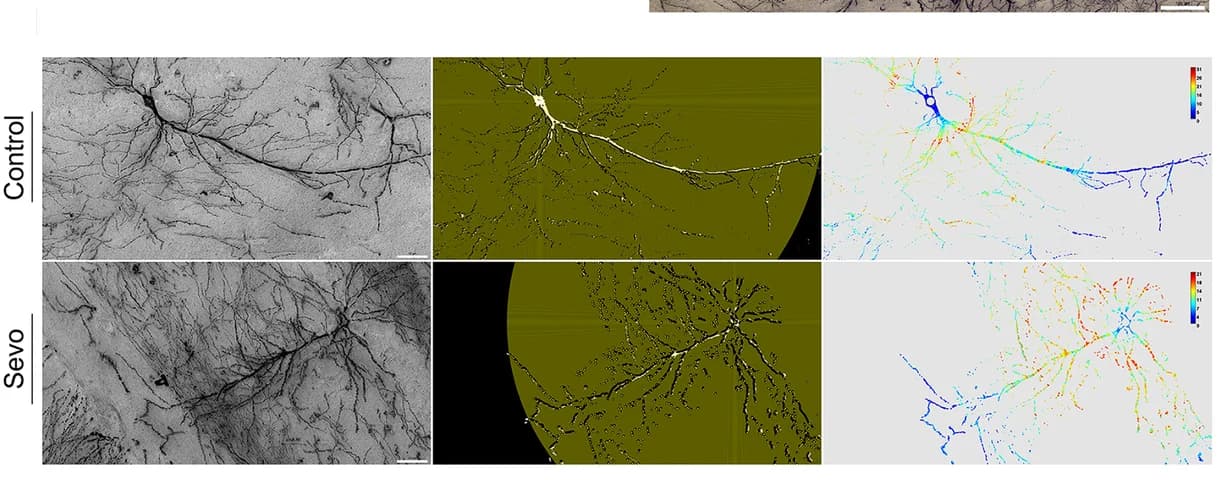 Open access visualization of Microscopy, Sholl Analysis, Anesthesia, Neuron, Dendrite