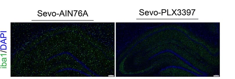 Open access visualization of Microscopy, iba1, Microglia, Hippocampus, PLX3397