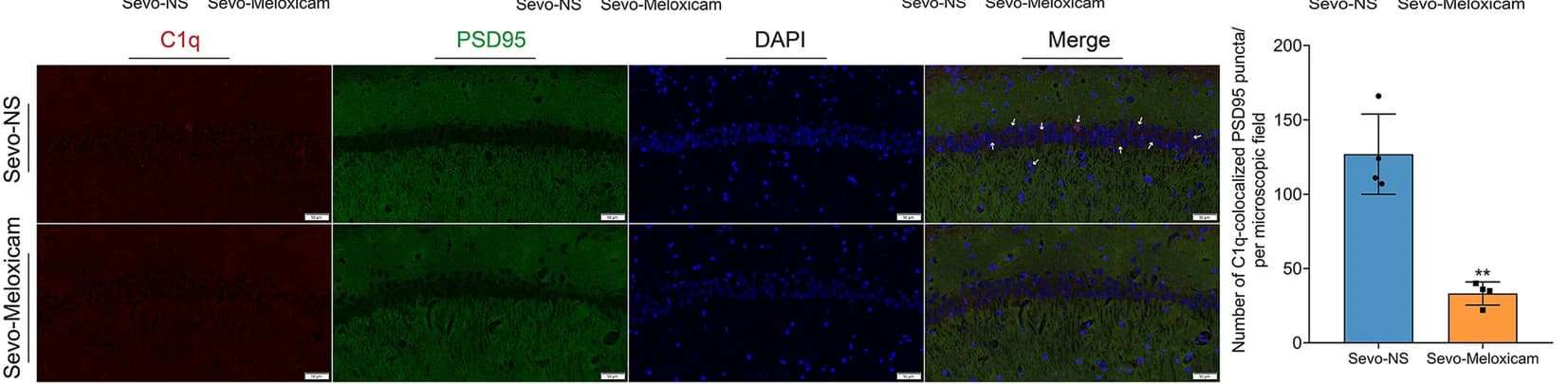Open access visualization of Microscopy, Bar Plot, Error Bars, Neuroinflammation Suppression, Complement