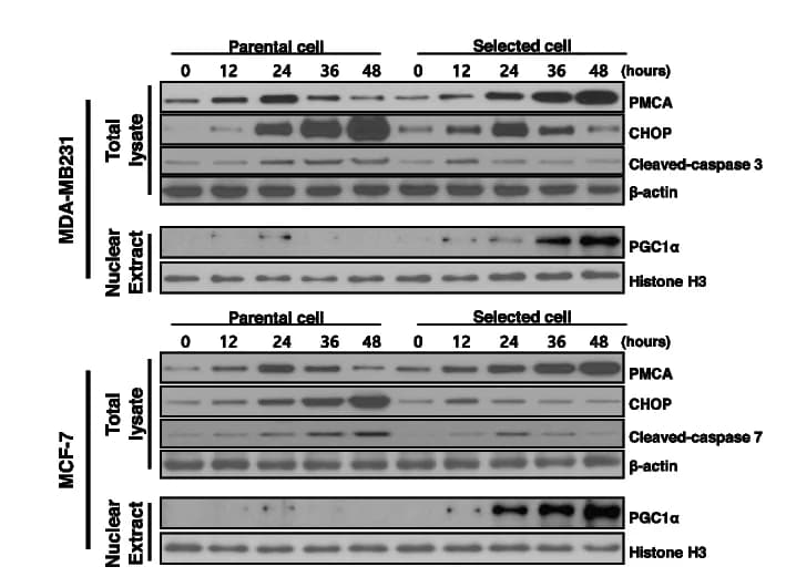 Open access visualization of Gel, Immunoblot Analysis, PMCA, CHOP, PGC1α
