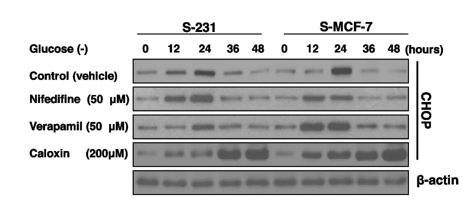 Open access visualization of Gel, Immunoblot Analysis, CHOP, ER Stress Marker, Calcium Channel Blockers
