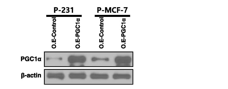 Open access visualization of Gel, Immunoblot Analysis, PGC1alpha, PMCA, PGC1alpha Overexpression