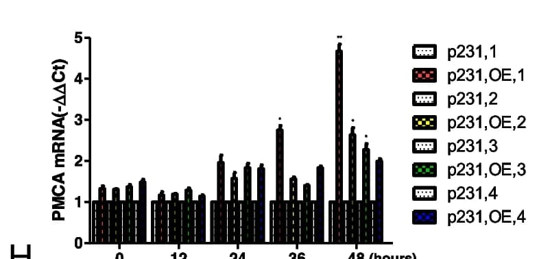 Open access visualization of Bar Plot, qRT-PCR, mRNA expression, PMCA Family, Glucose Deprivation