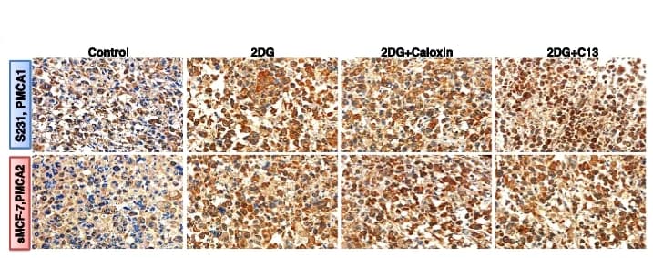 Open access visualization of Microscopy, PMCA1, PMCA2, S-231, S-MCF-7