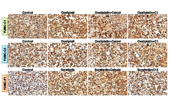 Open access visualization of Microscopy, Immunohistochemistry, PMCA, Xenograft, Tumor tissues