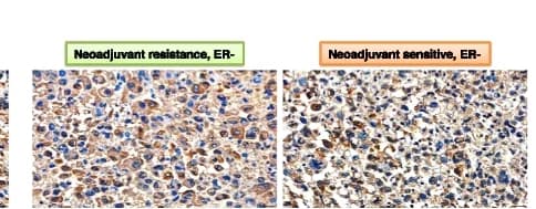 Open access visualization of Microscopy, Immunohistochemistry, Image analysis, PMCA, Tumor tissues