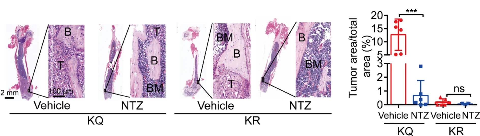 Open access visualization of Microscopy, Box Plot, Scatter Plot, Nitazoxanide, Bone Tumor Areas