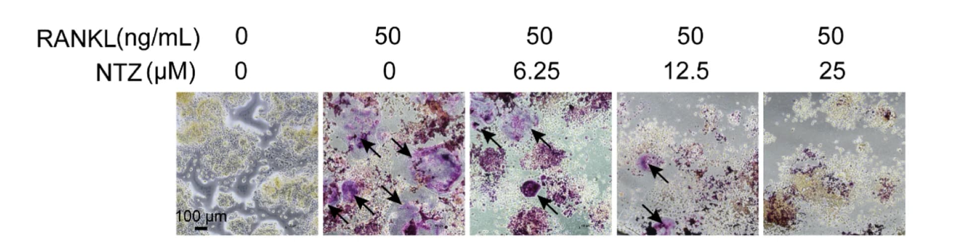 Open access visualization of Microscopy, Photo, Osteoclast Differentiation, TRAP Staining, RAW264.7 Cells
