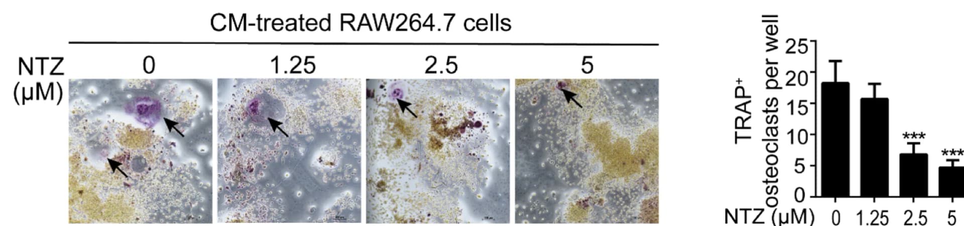 Open access visualization of Bar Plot, Error Bars, Microscopy, Osteoclast Differentiation, RAW264.7 Cells