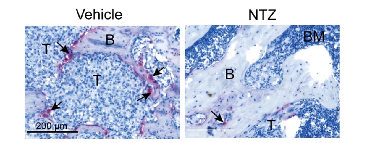 Open access visualization of Microscopy, Osteoclasts, Mouse Bones, Bone Sections, TRAP