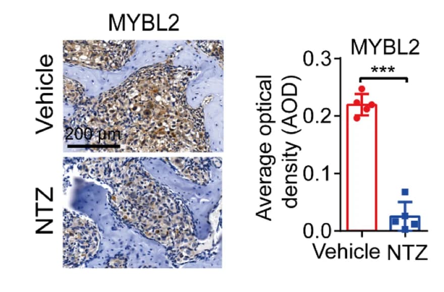 Open access visualization of Bar Plot, Microscopy, Error Bars, NTZ, MYBL2