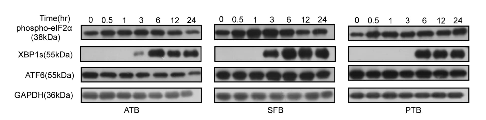 Open access visualization of Gel, Phospho-eIF2α, EIF2S1, XBP1s, ATF6