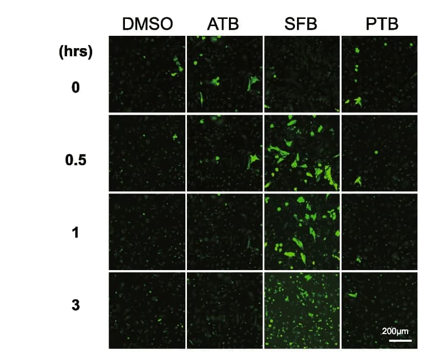 Open access visualization of Microscopy, Fluorescence Images, NRCMs, Calbryte 520 AM, TKI Treatments
