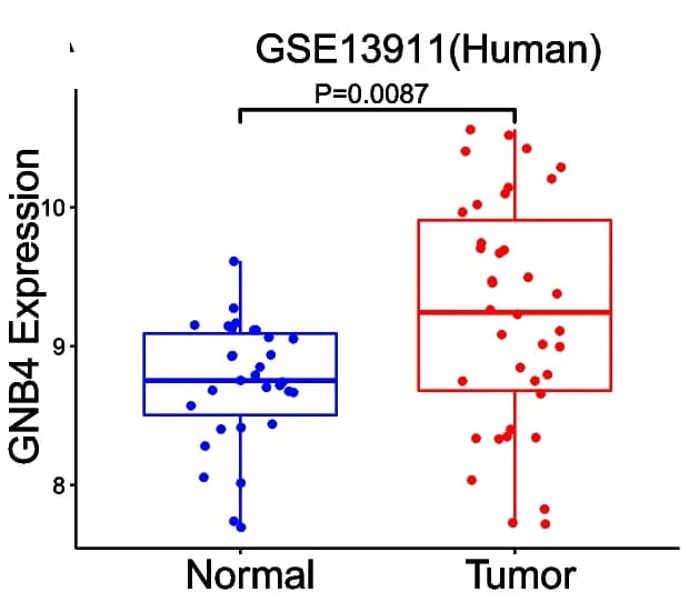 Open access visualization of Box Plot, Scatter Plot, GNB4 Expression, GC Tissues, Normal Tissues
