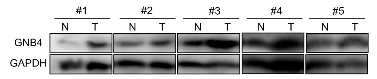 Open access visualization of Gel, Protein Expression, GNB4, GC Tissues, Normal Tissues