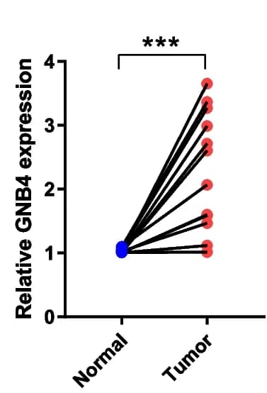 Open access visualization of Line Plot, Scatter Plot, qRT-PCR Analysis, GNB4 mRNA Expression, GC Tissues