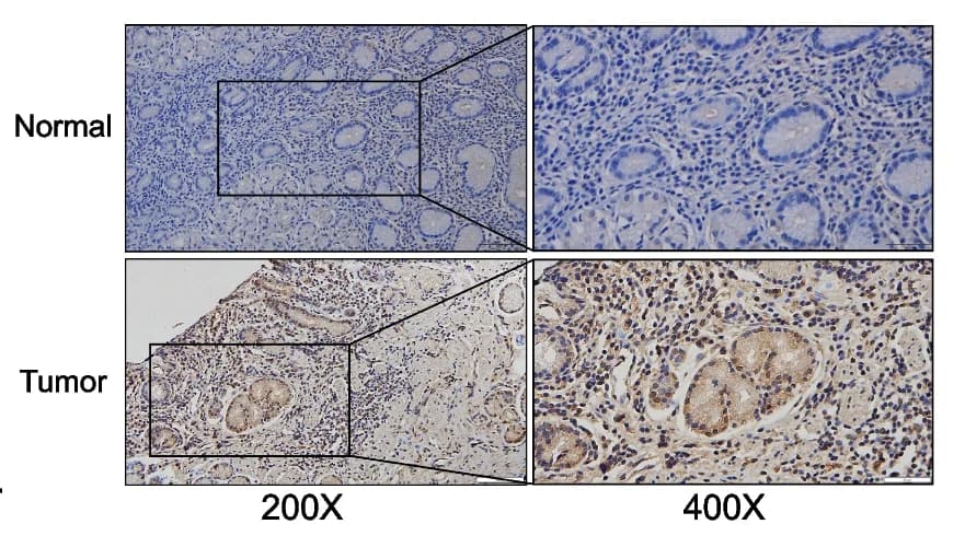 Open access visualization of Microscopy, IHC Staining, GNB4, Normal Tissues, GC Tissues