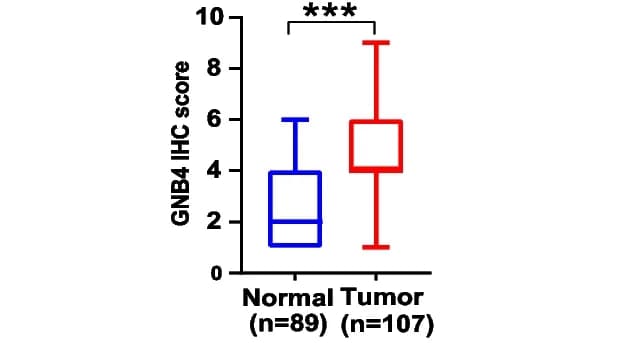 Open access visualization of Box Plot, H-score, GNB4, Normal Tissues, GC Tissues