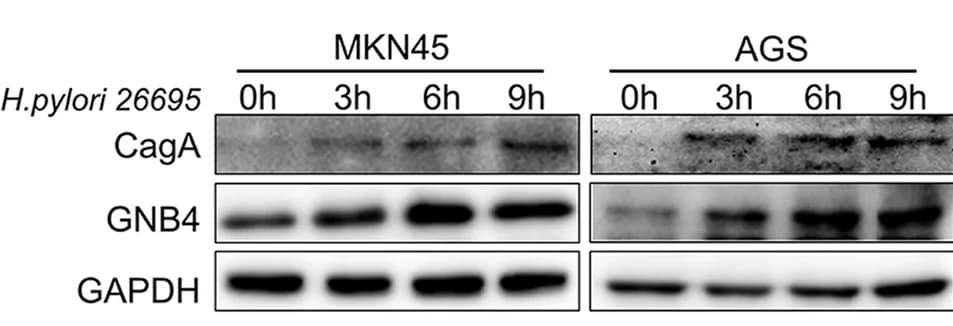 Open access visualization of Gel, Western Blot, GNB4, CagA, AGS Cells