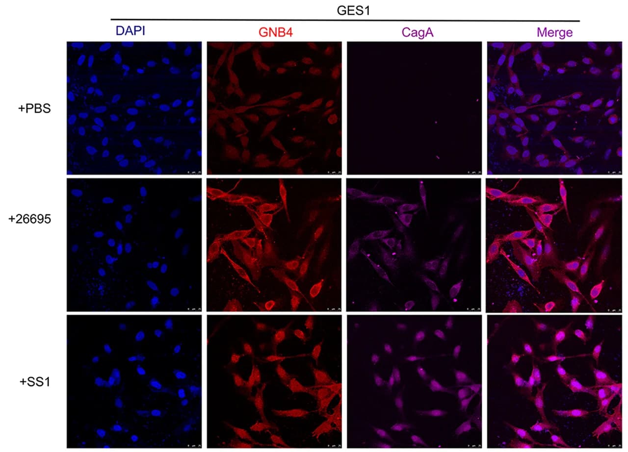Open access visualization of Microscopy, GES1 Cells, H. pylori 26695, H. pylori SS1, Immunofluorescence Staining