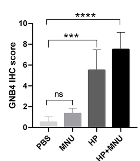 Open access visualization of Bar Plot, Error Bars, IHC Score, GNB4, PBS Group