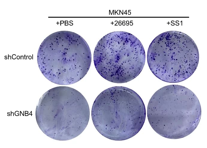 Open access visualization of Photo, Colony Formation Assay, Cell Proliferation, MKN45 cells, shControl