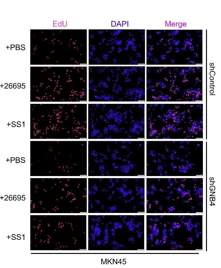 Open access visualization of Microscopy, EdU Assay, MKN45 cells, shControl, shGNB4