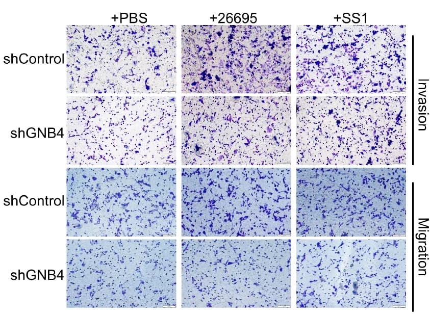 Open access visualization of Microscopy, Transwell Assay, Cell Migration, Cell Invasion, MKN45 cells