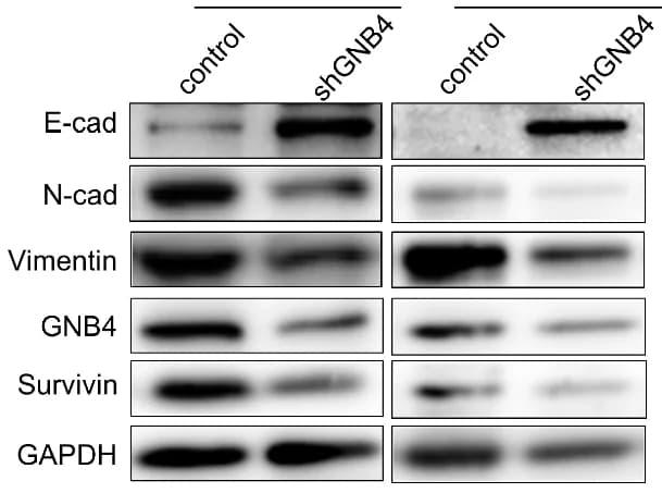 Open access visualization of Gel, Protein Expression, GNB4, E-cadherin, N-cadherin