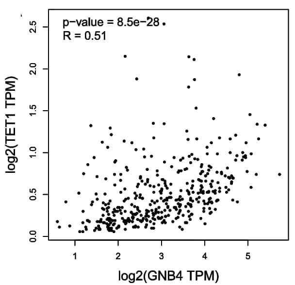 Open access visualization of Scatter Plot, Regression Plot, GNB4, TET1, Gastric Cancer