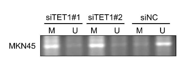 Open access visualization of Gel, Promoter Methylation, GNB4, MKN45 cells, TET1 siRNA