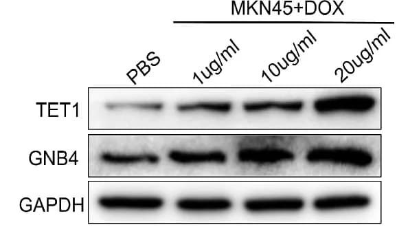 Open access visualization of Gel, Western Blotting, TET1, GNB4, Expression