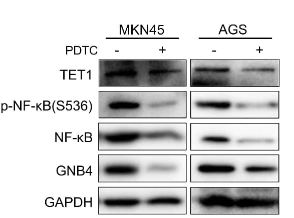 Open access visualization of Gel, Western Blotting, TET1, p-NF-κB, NF-κB