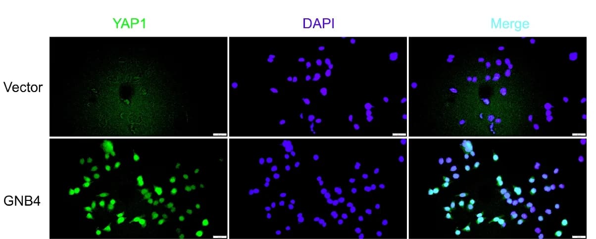 Open access visualization of Microscopy, Immunofluorescence, YAP1, AGS Cells