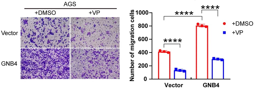 Open access visualization of Bar Plot, Error Bars, AGS Cells, Verteporfin, GNB4 Overexpression