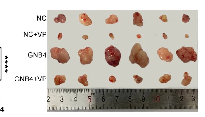 Open access visualization of Photo, Gel, Bar Plot, Error Bars, Subcutaneous Tumor Model