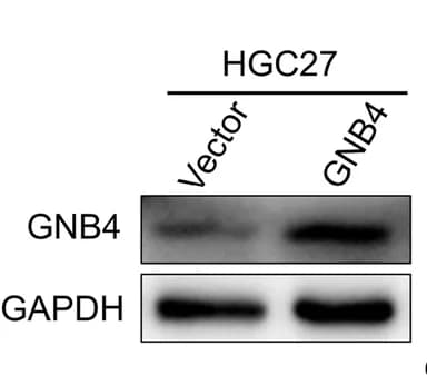 Open access visualization of Gel, Western Blot, GNB4 Protein, HGC27 Cells, Lentivirus