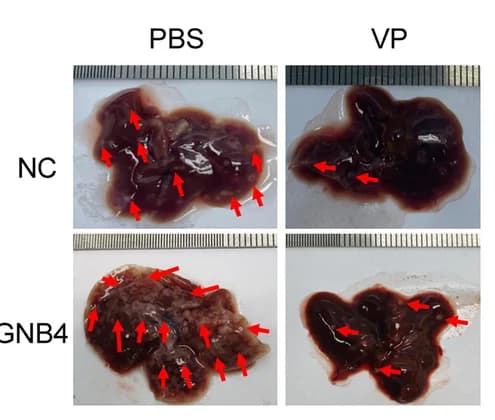 Open access visualization of Photo, Mouse Xenograft, HGC27 Cells, MKN45 Cells, GNB4 Overexpression